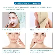 5PCS Blackhead & Comedone Extractor Kit